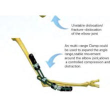 Ellenbogen Fixateur System